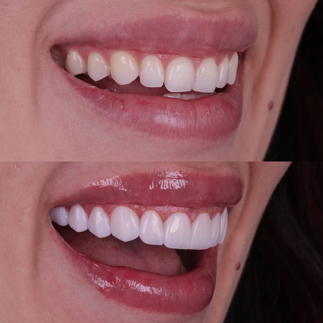 Snapins.ai_469584106_618350314098423_1239551559412989235_n_1080