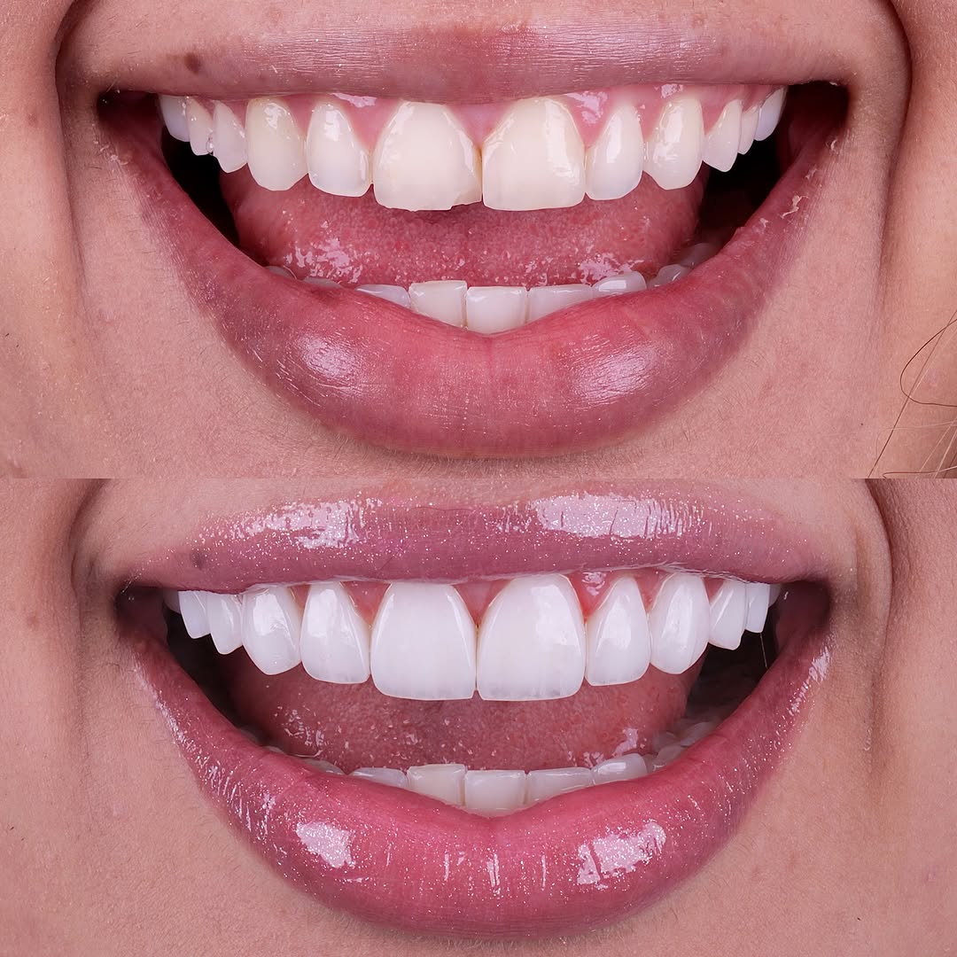 Snapins.ai_481993331_18093414472551555_5125020220361073665_n_1080